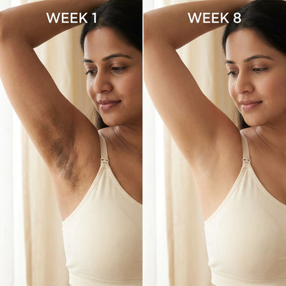 Before After Week 1 Week 8 - Postpartum