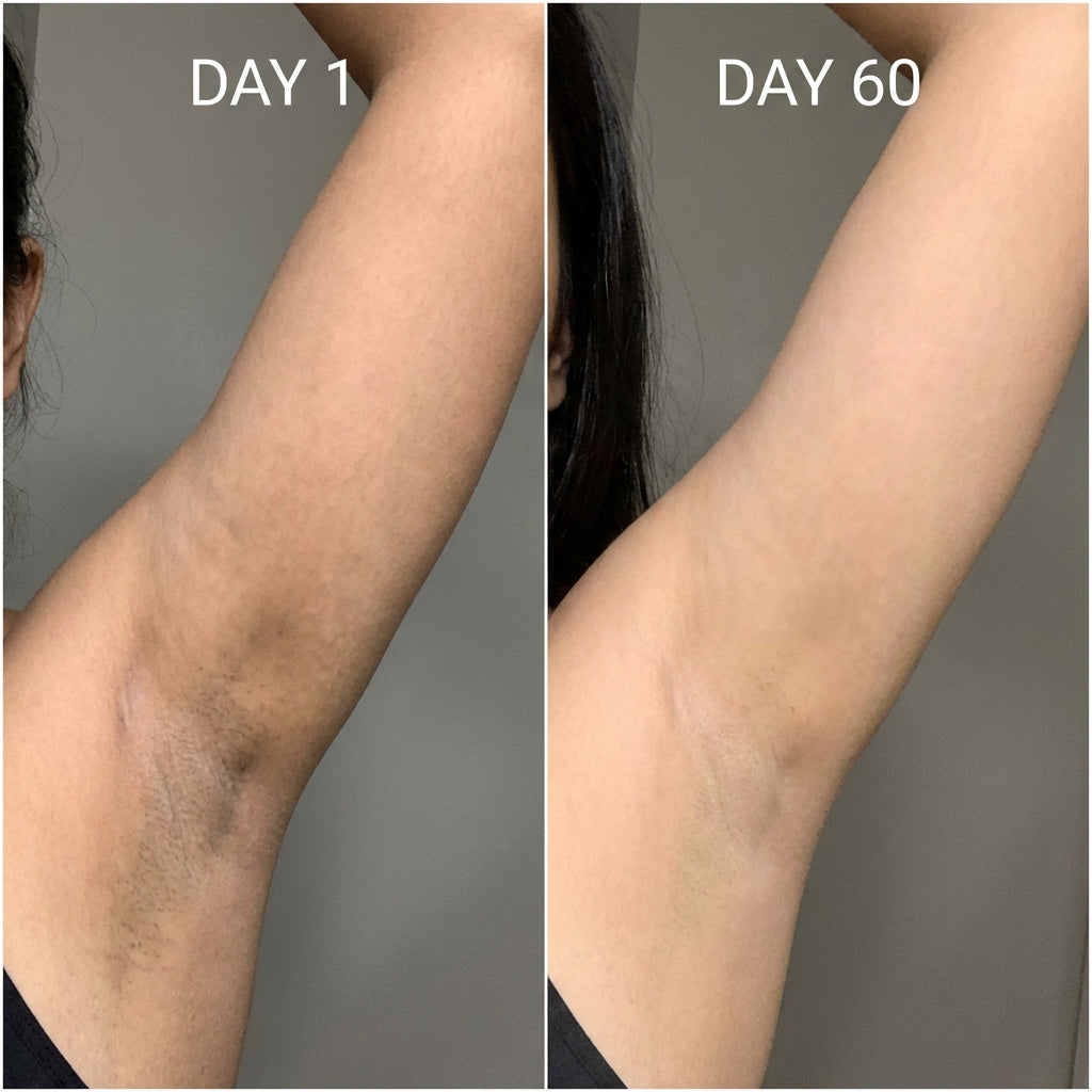 Before After Day 1 Day 60 - South Asian
