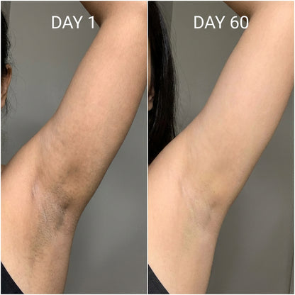 Before After Day 1 Day 60 - South Asian